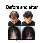 Herbal Hair Care Solution Anti-hair Loss And Strong