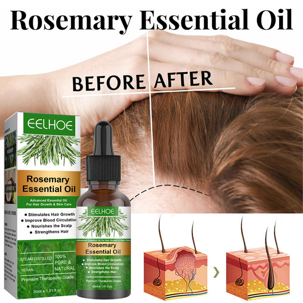 Rosemary Hair Care Essential Oil Anti-loss Hair Growth Hair Care Nourish Scalp Hair Roots